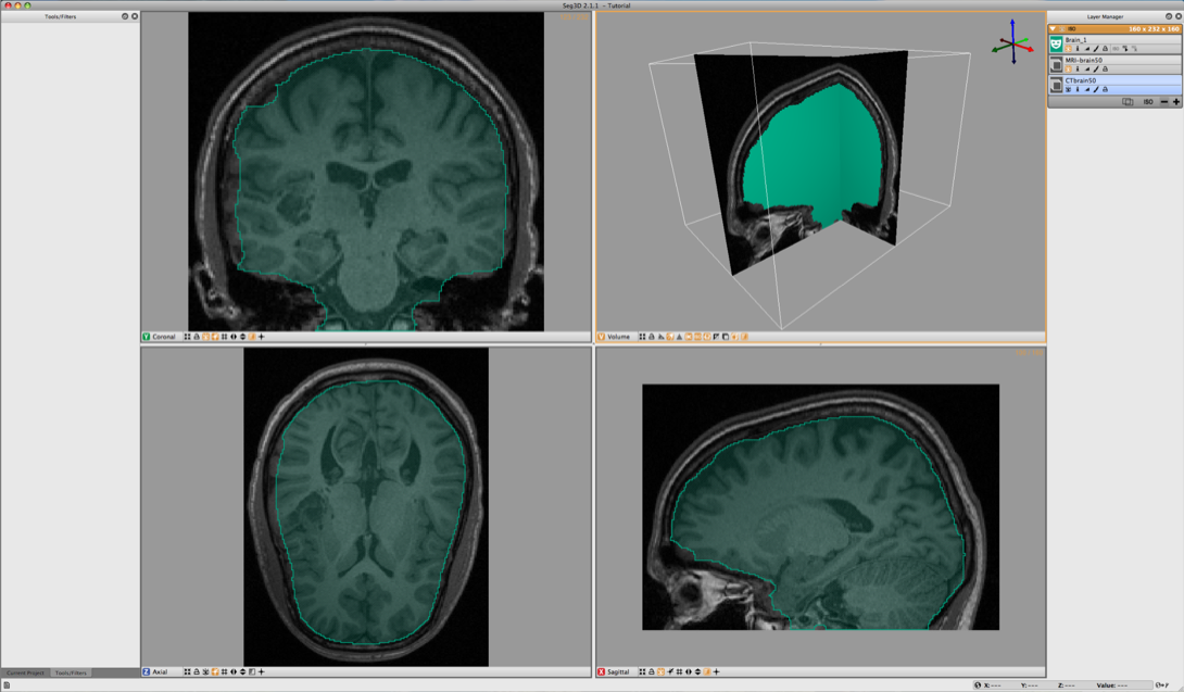 LoadingSegmentation